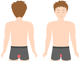 脱毛部位の図　-Iライン　Oライン-