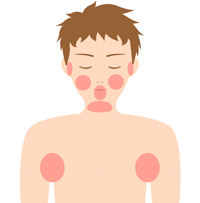 脱毛部位の図　-顔、脇など-