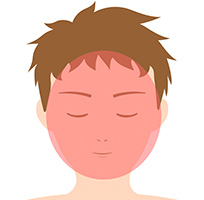 脱毛部位の図-フルフェイス-